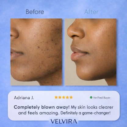 Hair Removal Trilogy Kit